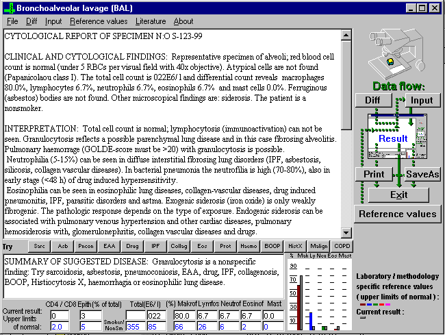 BAL2000 3.0 software screenshot