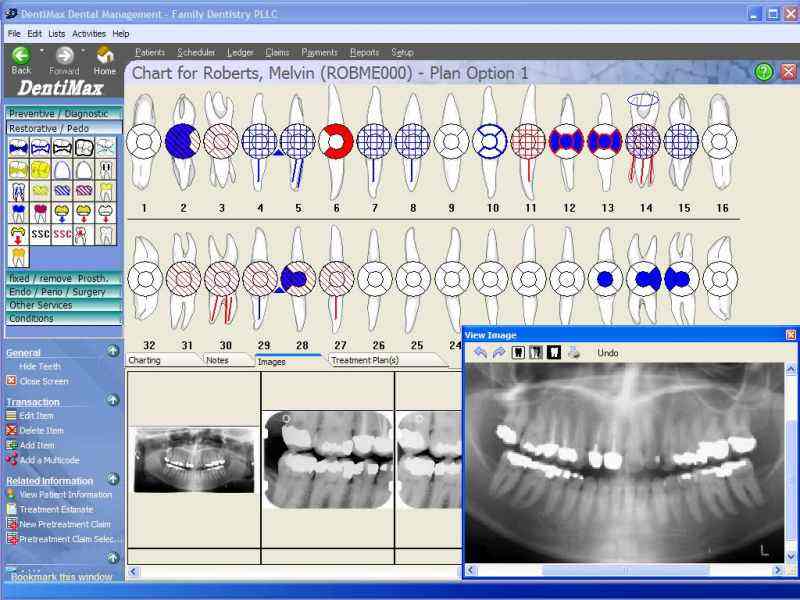 DentiMax Dental Software 08.01 software screenshot