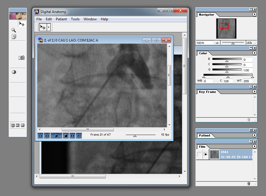 Digital Anatomy 1.0.25 software screenshot