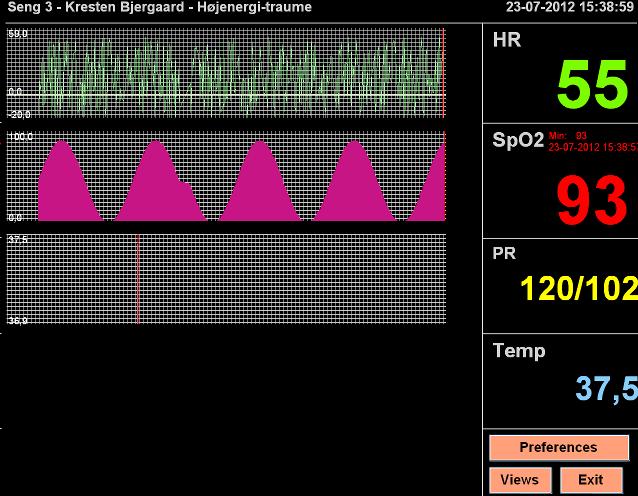 Patient Monitor 1.0.0.0 Alpha software screenshot