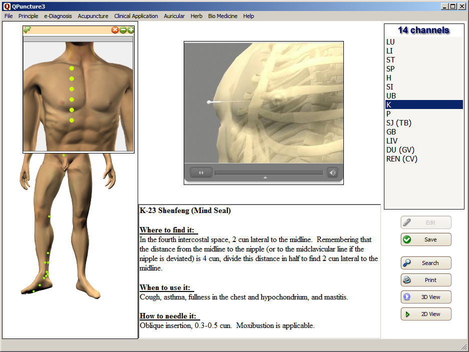 Qpuncture 3.00 software screenshot