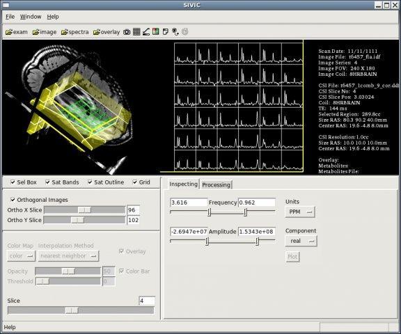 SIVIC 0.9.11 software screenshot